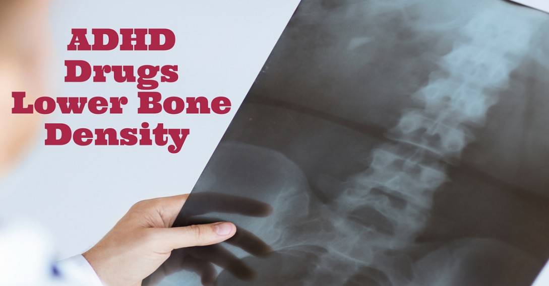 adhd drugs lower bone density in kids