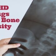 adhd drugs lower bone density in kids